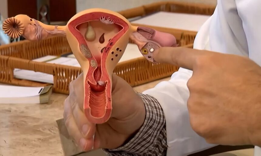 Aberta chamada pública para pesquisas científicas sobre endometriose